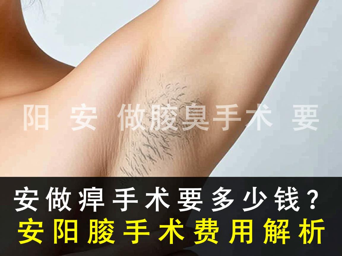 在安阳做腋臭手术要多少钱？安阳腋臭手术费用解析