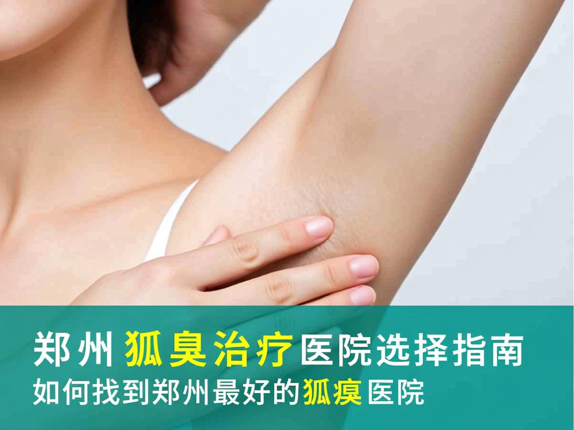 郑州狐臭治疗医院选择指南,如何找到郑州最好的狐臭医院 郑州狐臭治疗医院选择指南,如何找到郑州最好的狐臭医院