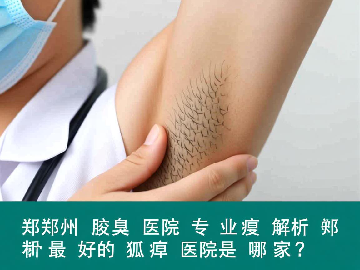郑州腋臭医院专业解析，郑州最好的狐臭医院是哪家？