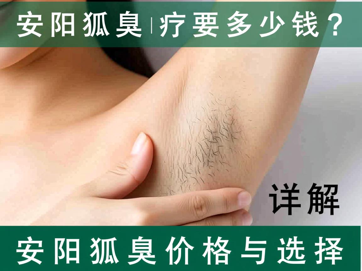 安阳狐臭治疗要多少钱？详解安阳狐臭价格与选择