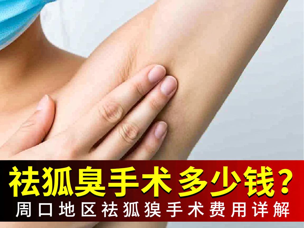 祛狐臭手术多少钱？周口地区祛狐臭手术费用详解