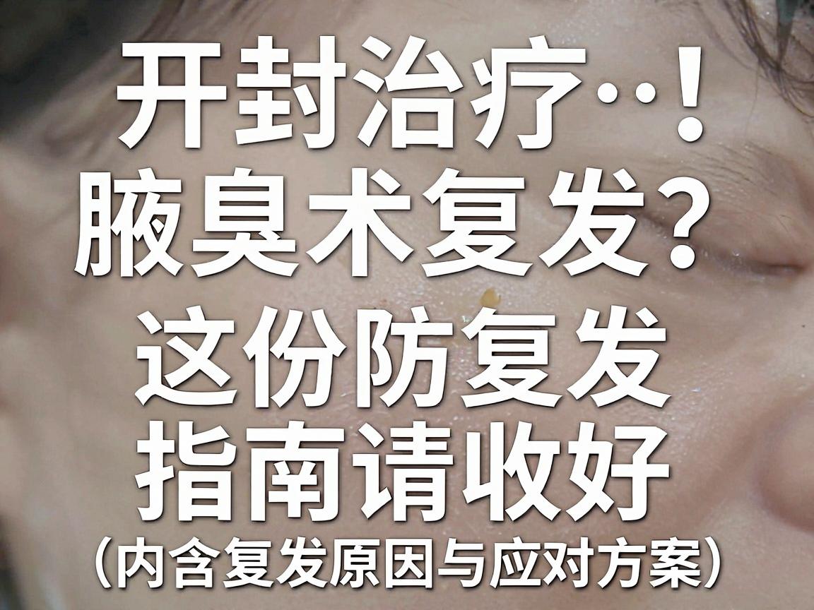 开封治疗腋臭手术复发?别怕!这份防复发指南请收好(内含复发原因与应对方案) 开封治疗腋臭手术复发?别怕!这份防复发指南请收好(内含复发原因与应对方案)