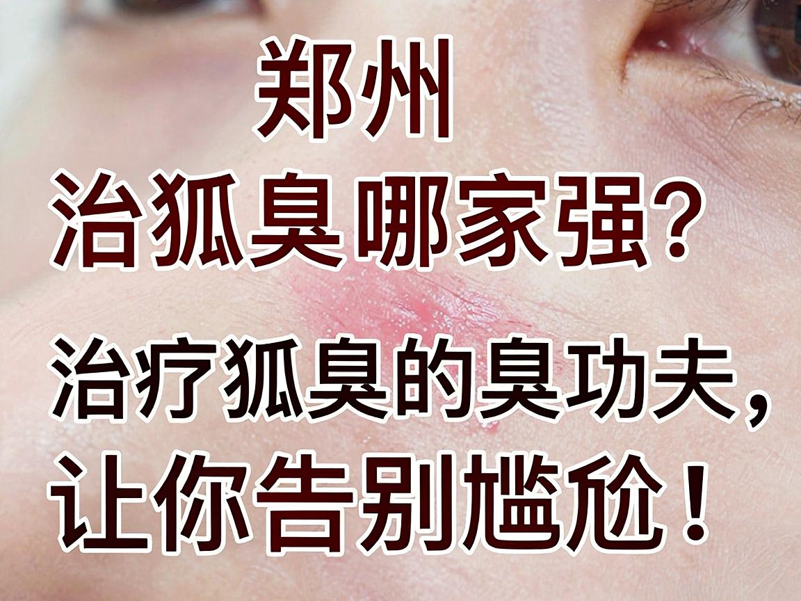 郑州治狐臭哪家强?这家医院治疗狐臭的臭功夫,让你告别尴尬! 郑州治狐臭哪家强?这家医院治疗狐臭的臭功夫,让你告别尴尬!