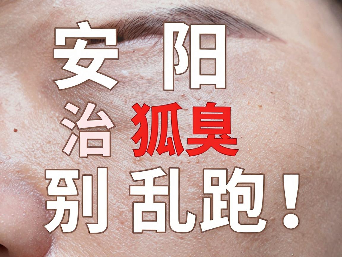 安阳治狐臭别乱跑!安阳专业医院治狐臭到底看哪家? 安阳治狐臭别乱跑!安阳专业医院治狐臭到底看哪家?