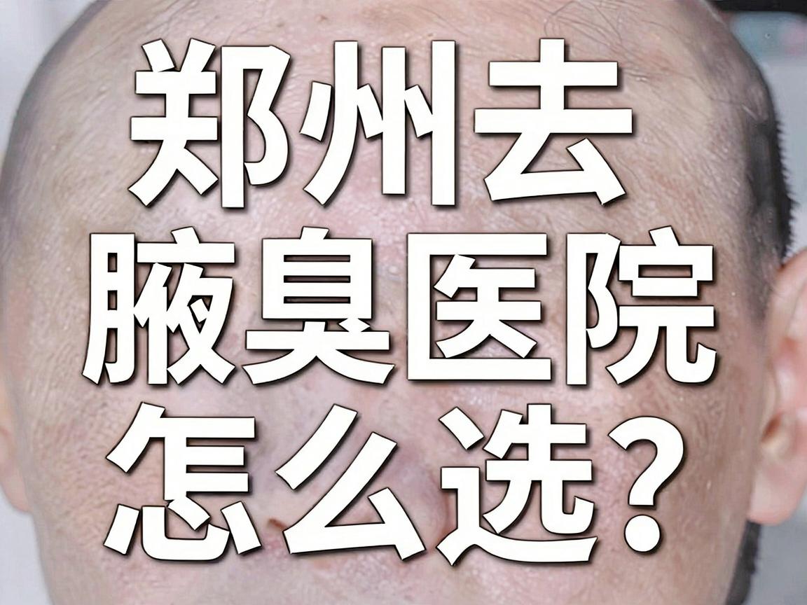 郑州去腋臭医院怎么选?这份郑州腋臭医院攻略请收好 郑州去腋臭医院怎么选?这份郑州腋臭医院攻略请收好
