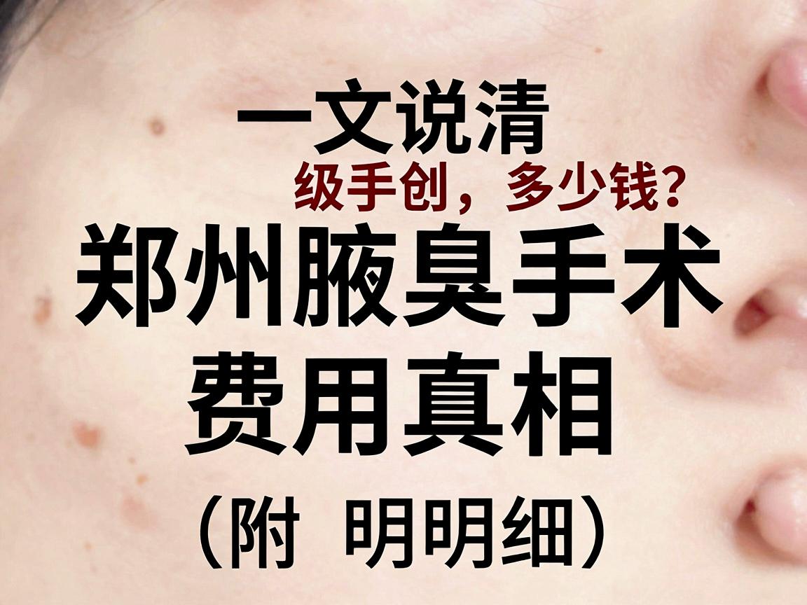 郑州腋臭微创手术多少钱?一文说清郑州腋臭手术费用真相(附明细) 郑州腋臭微创手术多少钱?一文说清郑州腋臭手术费用真相(附明细)