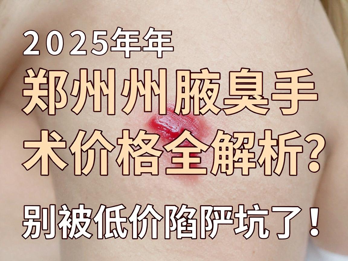 郑州腋臭手术多少钱?2025年郑州腋臭手术价格全解析,别被低价陷阱坑了! 郑州腋臭手术多少钱?2025年郑州腋臭手术价格全解析,别被低价陷阱坑了!