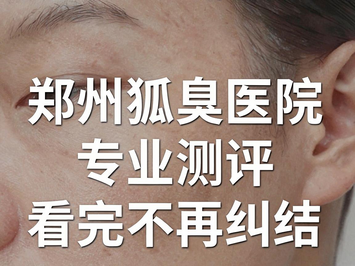 郑州狐臭医院哪家好?郑州狐臭医院专业测评,看完不再纠结 郑州狐臭医院哪家好?郑州狐臭医院专业测评,看完不再纠结
