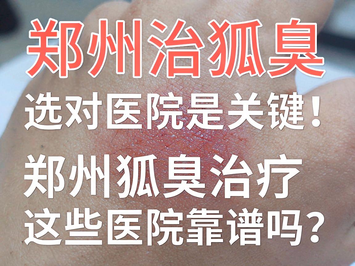 郑州治狐臭,选对医院是关键,郑州狐臭治疗,这些医院靠谱吗? 郑州治狐臭,选对医院是关键,郑州狐臭治疗,这些医院靠谱吗?