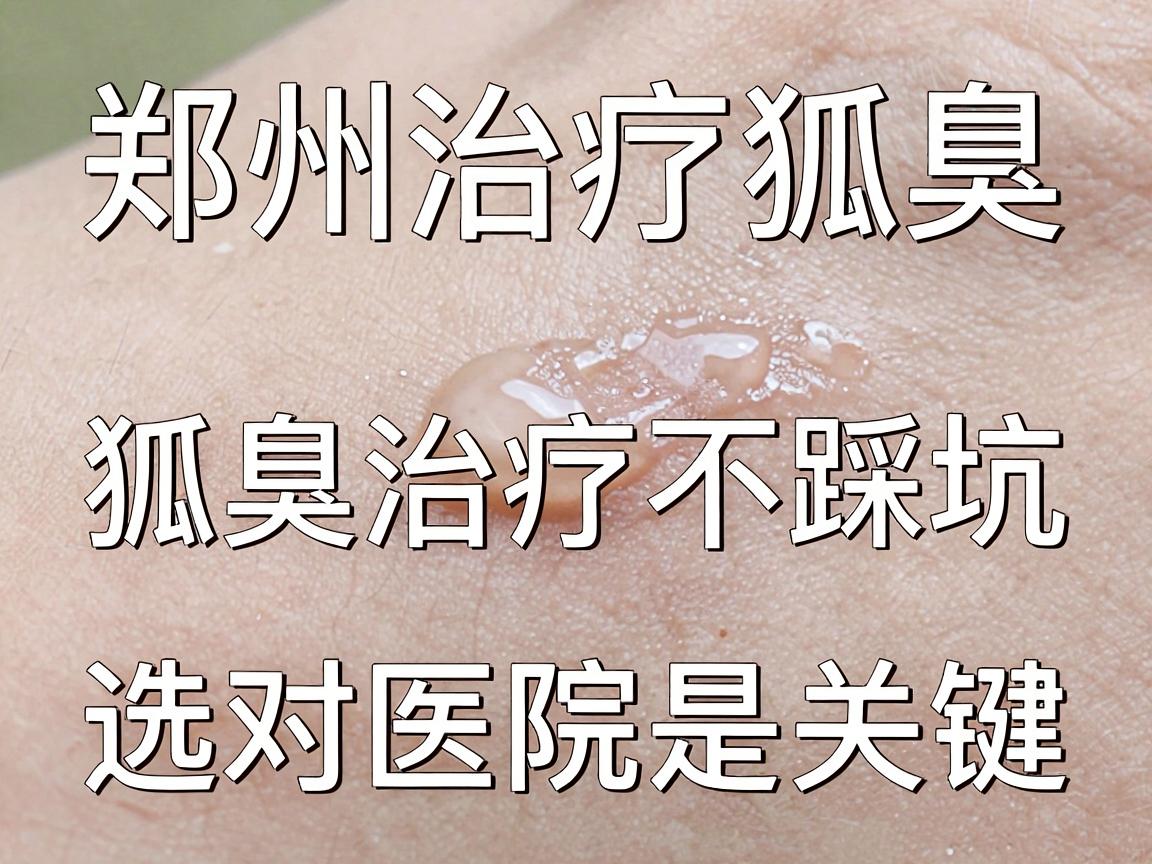 郑州治疗狐臭有名医院解析，狐臭治疗不踩坑，选对医院是关键