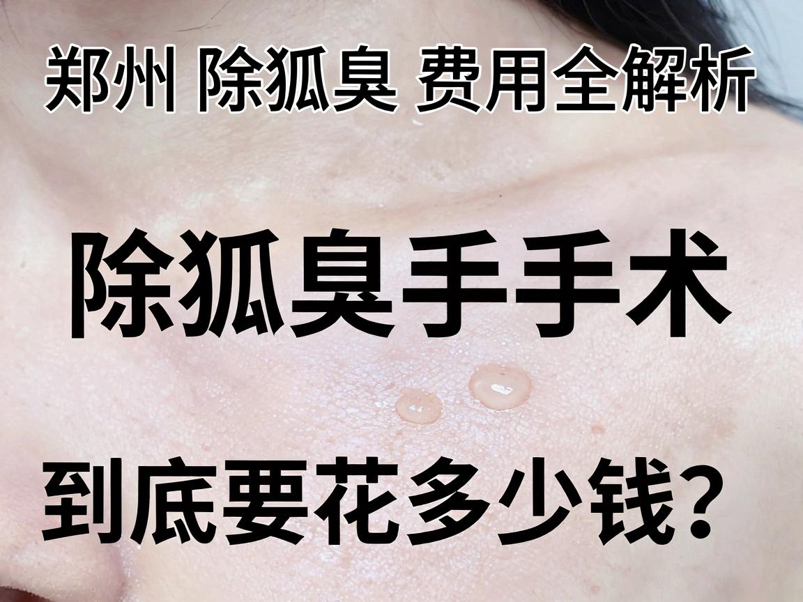 郑州除狐臭费用全解析，除狐臭手术到底要花多少钱？这篇告诉你真实费用