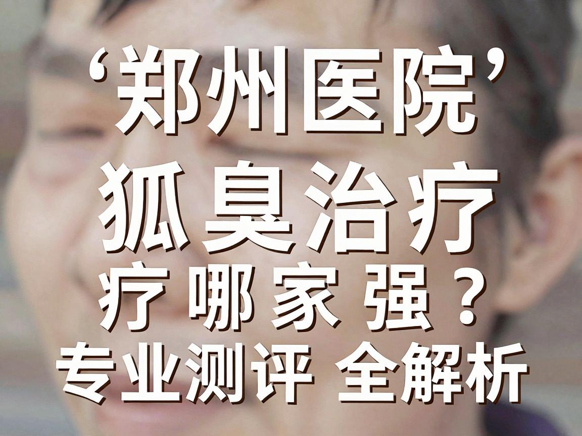 狐臭治疗哪家强?郑州医院狐臭治疗排名与专业测评全解析 狐臭治疗哪家强?郑州医院狐臭治疗排名与专业测评全解析