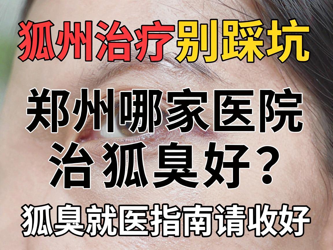 郑州狐臭治疗别踩坑,郑州哪家医院治狐臭好?这份狐臭就医指南请收好 郑州狐臭治疗别踩坑,郑州哪家医院治狐臭好?这份狐臭就医指南请收好