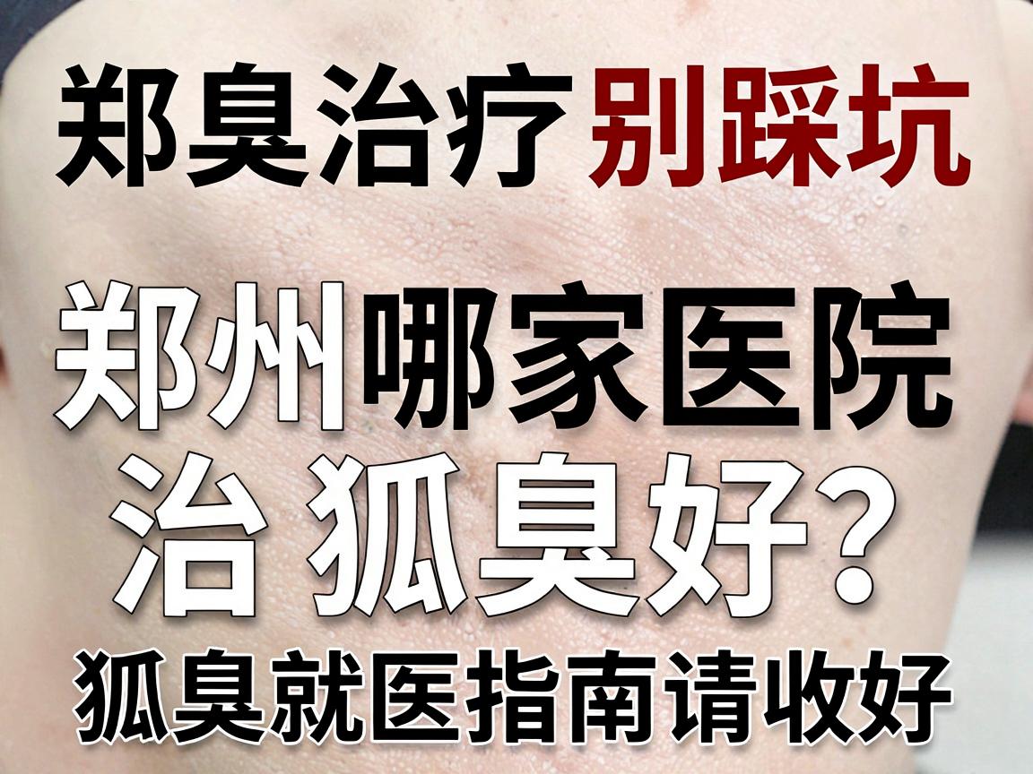 郑州狐臭治疗别踩坑,郑州哪家医院治狐臭好?这份狐臭就医指南请收好 郑州狐臭治疗别踩坑,郑州哪家医院治狐臭好?这份狐臭就医指南请收好