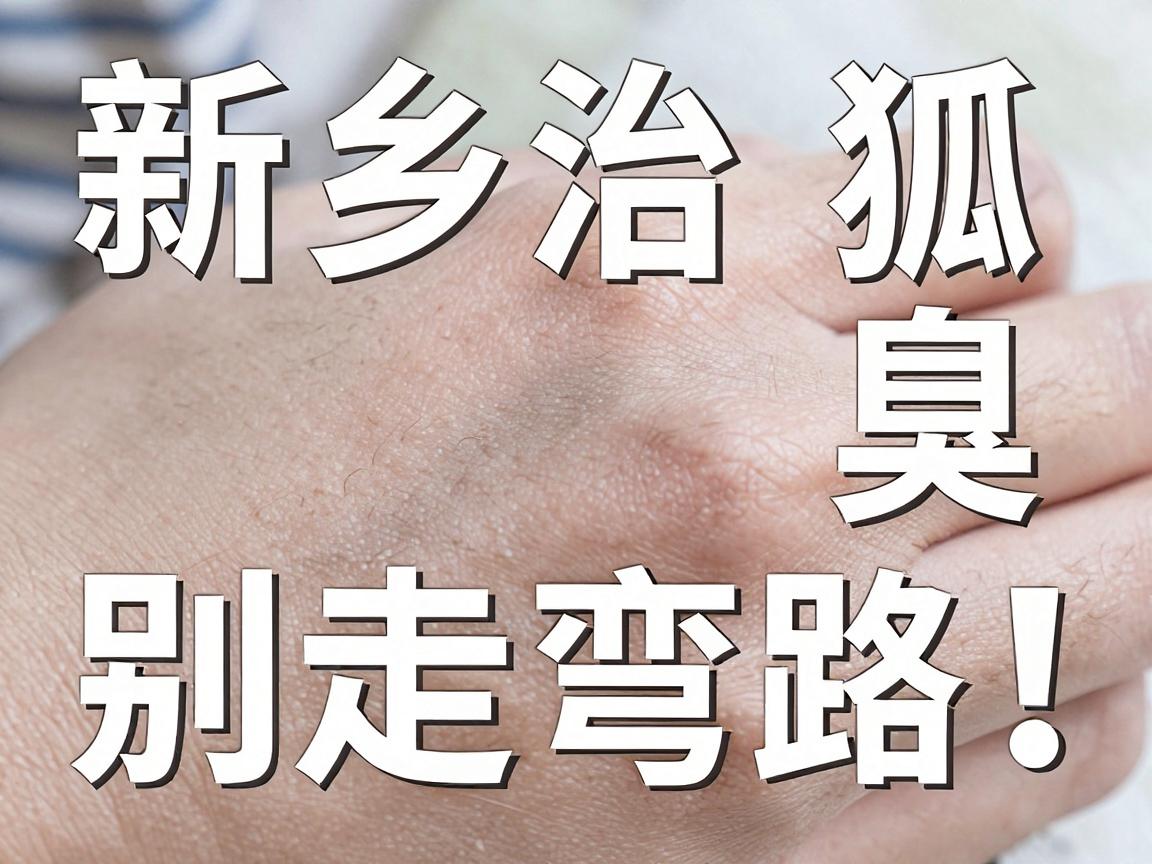 新乡治狐臭,别走弯路!新乡狐臭专科医生教你科学祛臭 新乡治狐臭,别走弯路!新乡狐臭专科医生教你科学祛臭