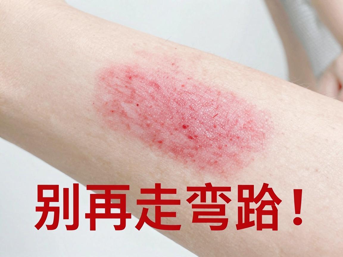 腋臭治疗别再走弯路!郑州附医腋臭医院揭秘,腋臭治疗的核心关键与误区 腋臭治疗别再走弯路!郑州附医腋臭医院揭秘,腋臭治疗的核心关键与误区